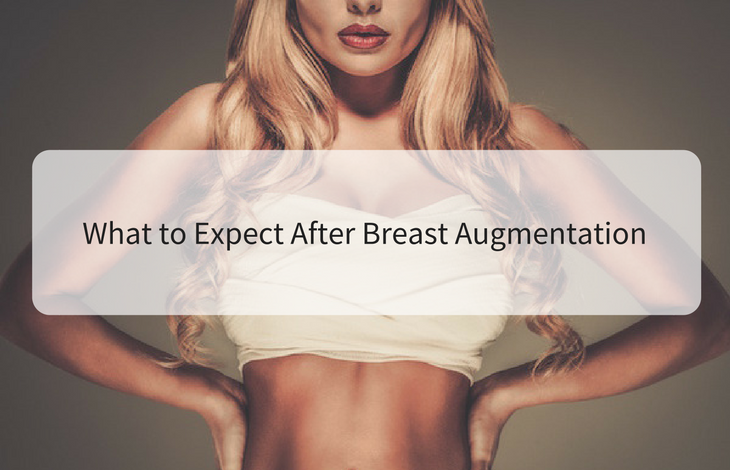 What to expect after breast augmentation